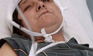 Экологов разбудили битами