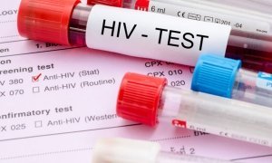 Центр по профилактике СПИДа предложил обследовать всех россиян