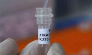 В России зафиксировано уже восемь случаев заболевания вирусом Зика