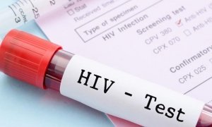 Роспотребнадзор призвал власти увеличить финансирование лечения ВИЧ-инфицированных