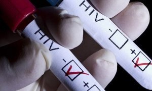Число больных СПИДом в России выросло до миллиона человек