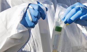 Роспотребнадзор сообщил о возможности провериться на коронавирус на дому