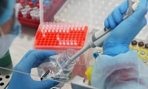 Московские врачи будут ставить диагноз «коронавирус» уже после первой положительной пробы