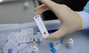 Россиян будут тестировать на ВИЧ прямо на рабочем месте