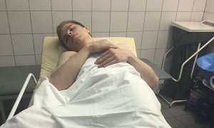 Избитого полицейскими волонтера штаба Навального забрали из больницы в ОВД