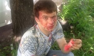 В Ульяновске неизвестные избили лидера местного отделения партии ПАРНАС
