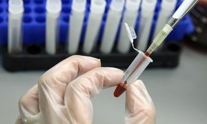 ЕСПЧ разрешил ВИЧ-инфицированным иностранцам проживать в России
