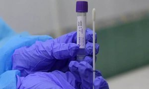 В России число заразившихся коронавирусом выросло на 302 человека