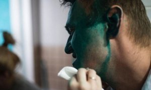 Навальный подаст жалобу на бездействие силовиков. Они не ловят напавших на него хулиганов