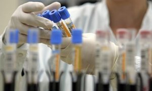 Минздрав отказался от обязательного учета ВИЧ-инфицированных граждан