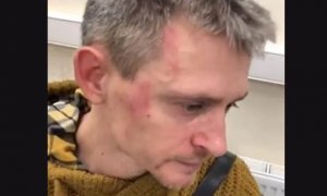 Московские полицейские избили активиста после слушаний по реновации района в Хорошево-Мневниках