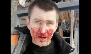 В Кемеровской области избили известного экоактивиста. Он утверждает, что это люди экс-депутата