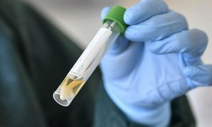 Власти Москвы заказали тесты на коронавирус у неизвестной фирмы без телефона и сайта