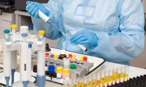 ВИЧ-инфицированные россияне пожаловались на невозможность сдать анализы в связи с загруженностью лабораторий