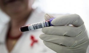 Американские ученые впервые с 2000 года выявили новый штамм ВИЧ