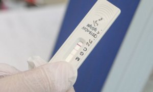 Москвичей с иммунитетом к коронавирусу обяжут соблюдать режим самоизоляции