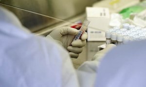 В Азербайджане у прилетевшего из Ирана россиянина обнаружили коронавирус