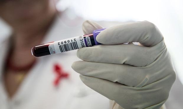 Кемеровская область стала лидером по количеству смертей ВИЧ-инфицированных