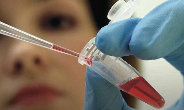 Свердловскую больницу обязали выплатить компенсацию пациентам после заражения ВИЧ