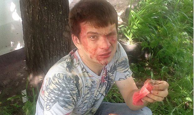 В Ульяновске неизвестные избили лидера местного отделения партии ПАРНАС