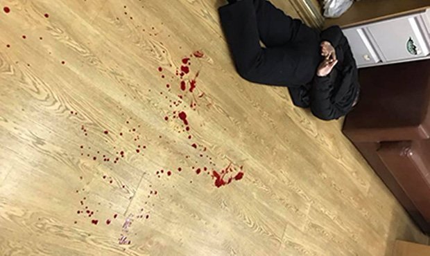 В Москве неизвестный мужчина с ножом напал на журналистку «Эха Москвы»