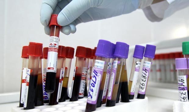 Британским медикам удалось вылечить ВИЧ-инфицированного пациента. Это уже второй случай в мире